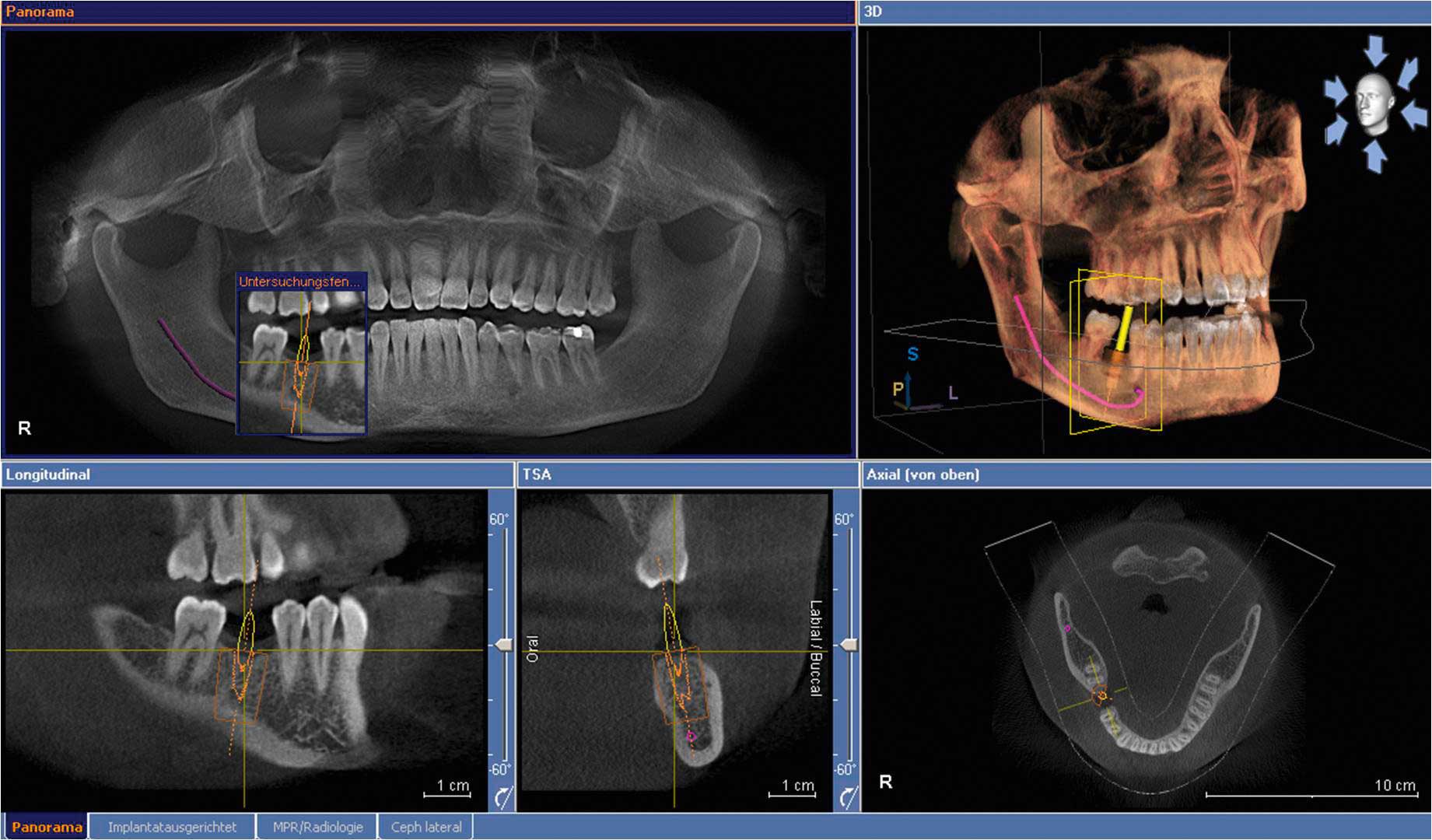Vatech 3D CB(Cone Beam) CT i3D Smart YK Dental Care